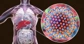 Hepatitis Explained